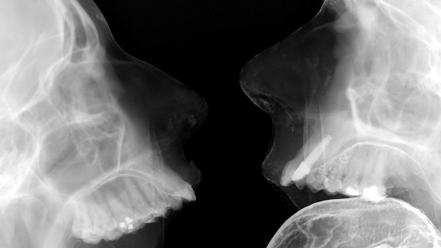 Skulls tongue x-ray wallpaper