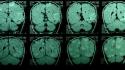 Skulls medicine brain doctors diseases scans mri wallpaper